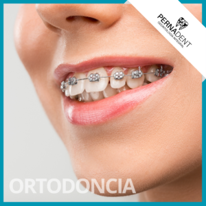 Ortodoncia